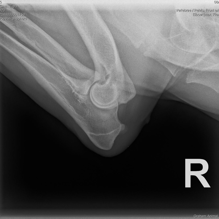 Tigras R Elbow X Ray